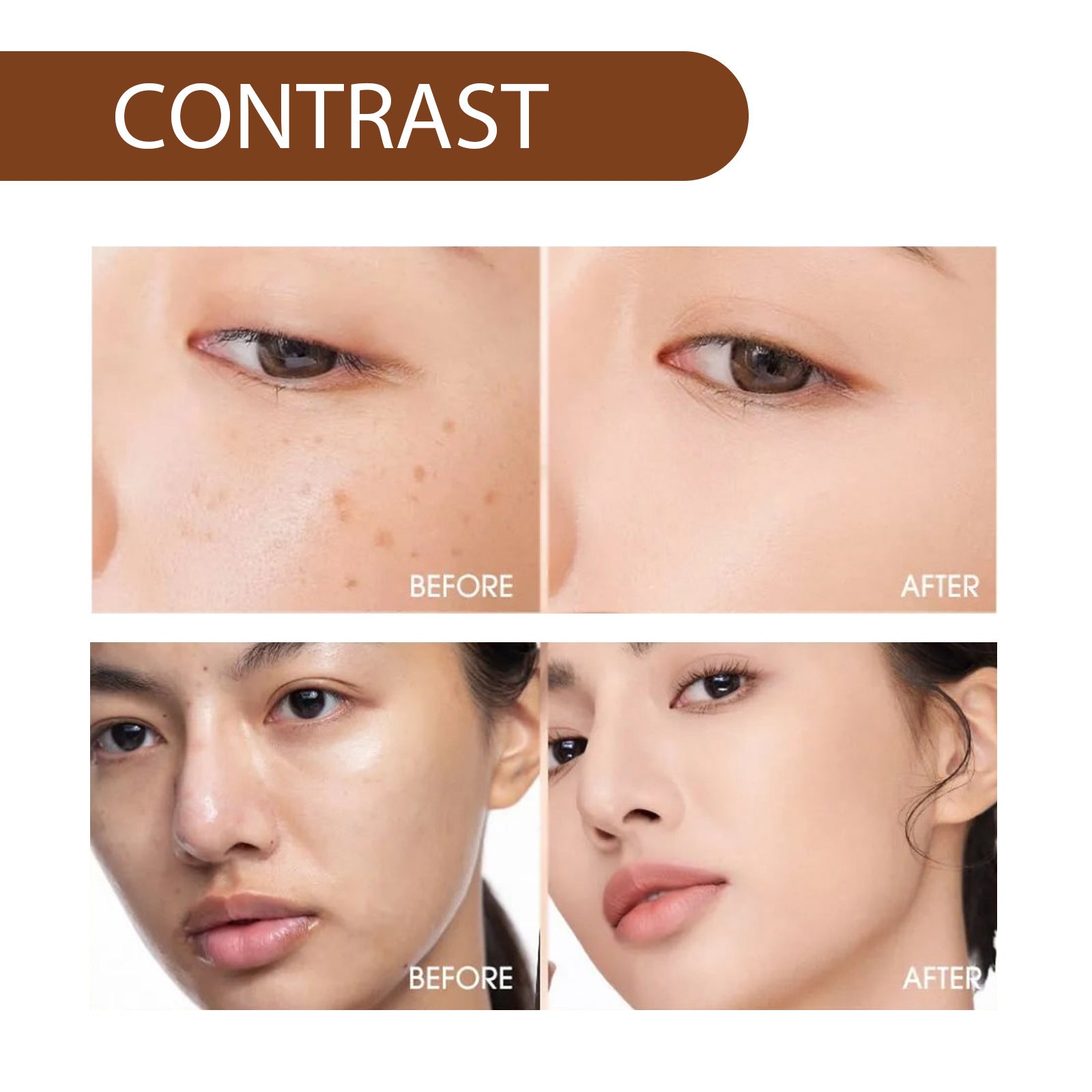 Hoygi Niacinamide Serum for Brightening and Hydration