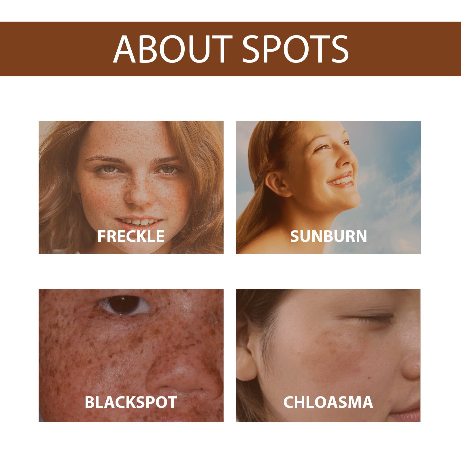 Hoygi Niacinamide Serum for Brightening and Hydration