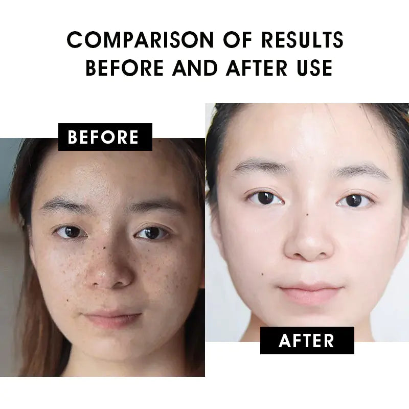 VITAMIN C SERUM - Creamy Firming Essence